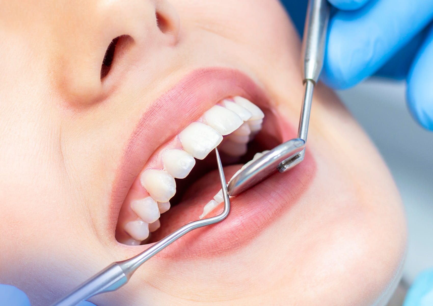 Types Of Dental Burs